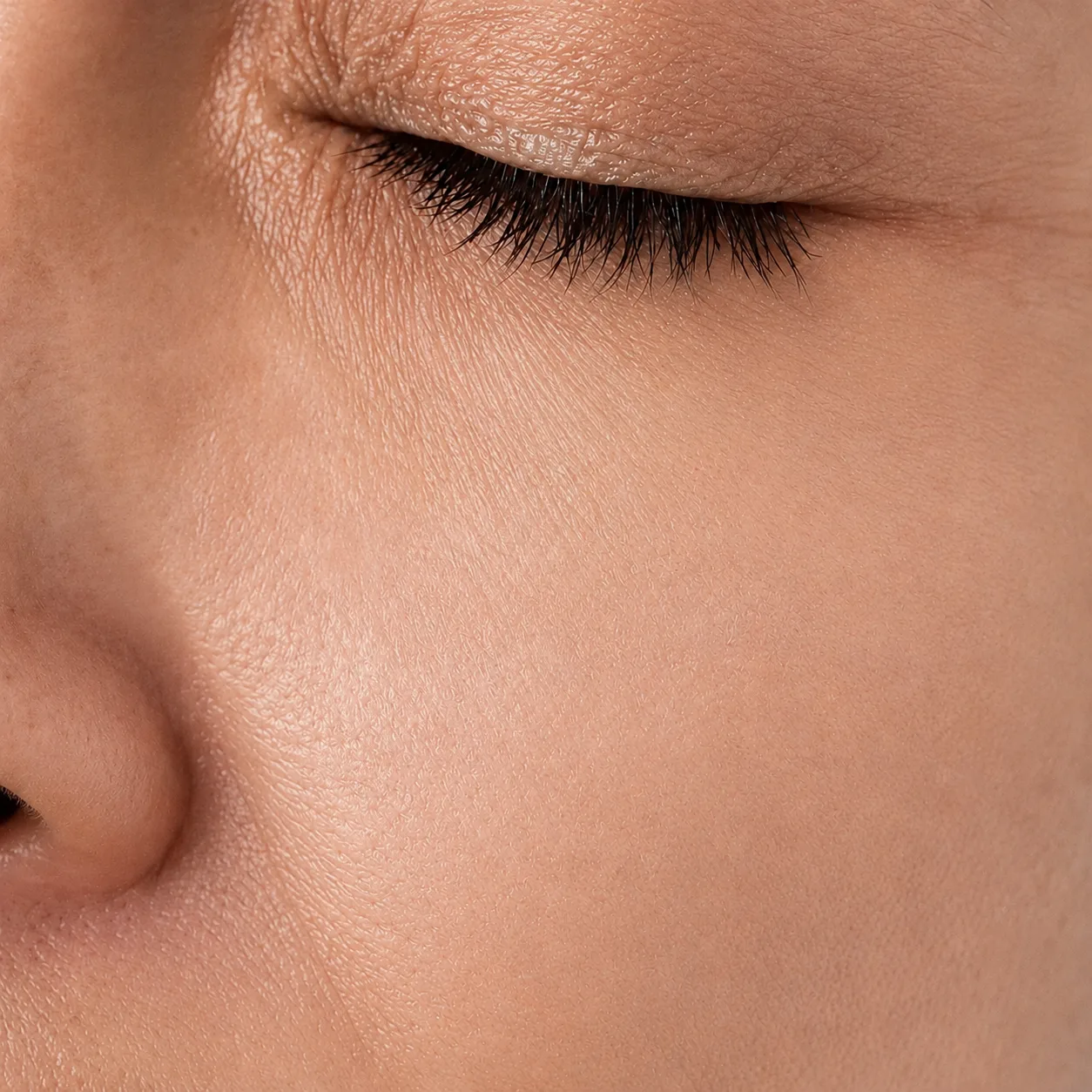 Piel uniforme y sin manchas después del tratamiento de melasma